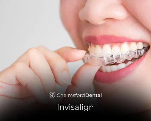 Invisalign treatment in Chelmsford