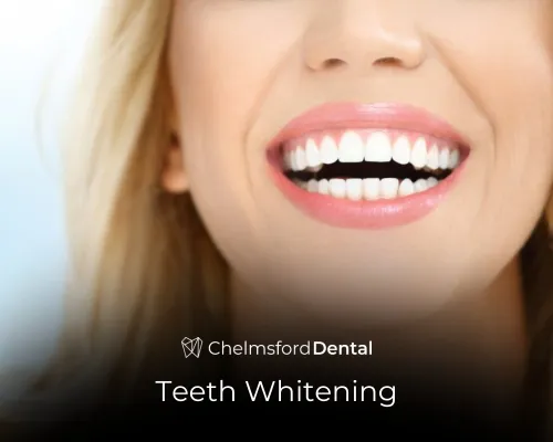 Teeth whitening treatment in Chelmsford